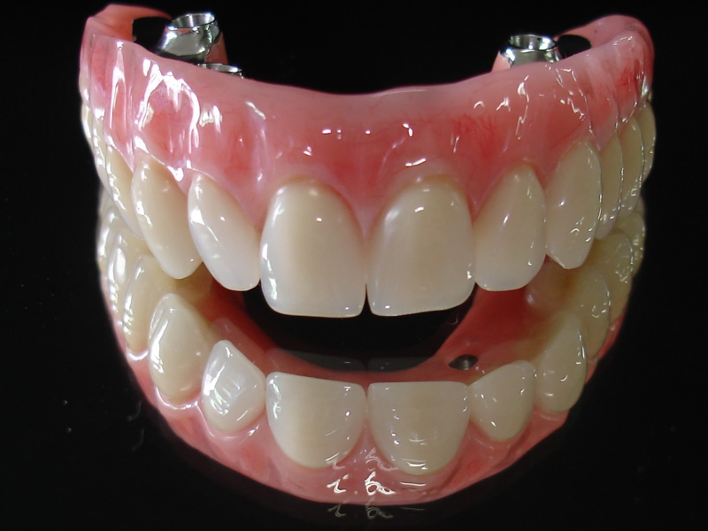 Próteses Totais Caracterizadas