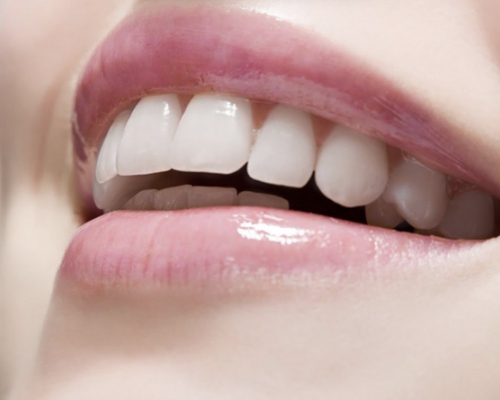 Periodontia (Tratamento e Cirurgias Gengival)