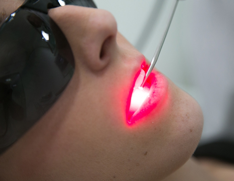 Laserterapia